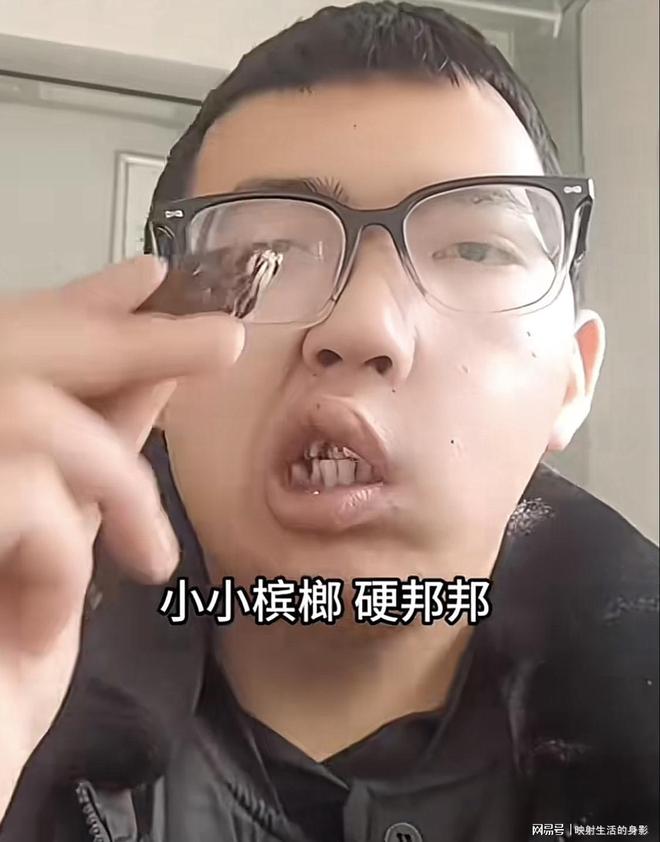 年导致脸部变形还边嚼边劝大家别碰槟榔龙8国际电子游戏娱乐平台男子嚼槟榔七(图1)